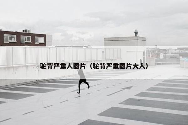 驼背严重人图片（驼背严重图片大人）