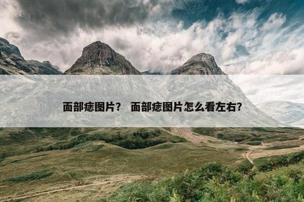 面部痣图片？ 面部痣图片怎么看左右？
